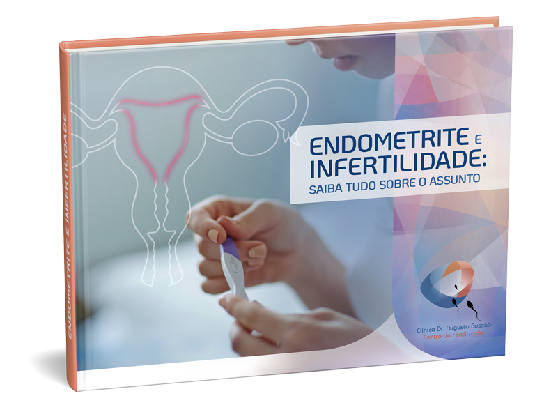 E-book |Endometrite e infertilidade: saiba tudo sobre o assunto | Dr. Augusto Bussab
