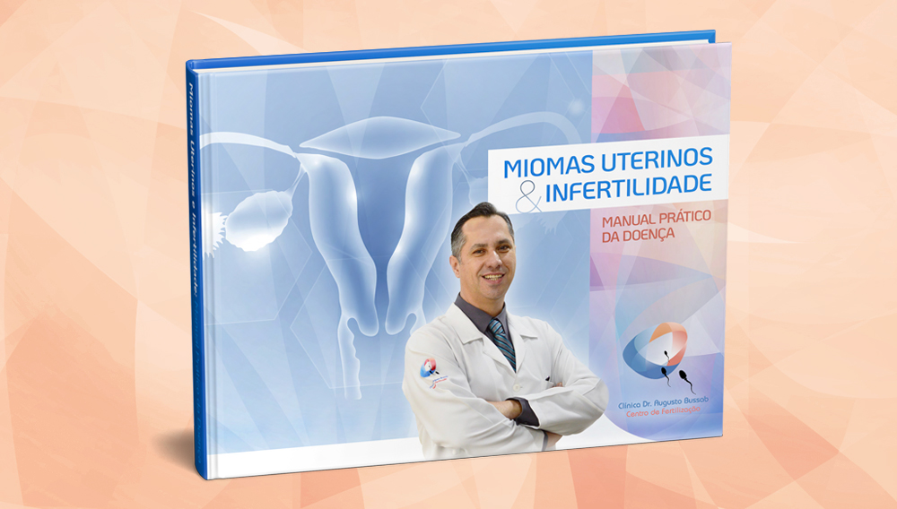E-book | Miomas Uterinos e Infertilidade! | Dr. Augusto Bussab